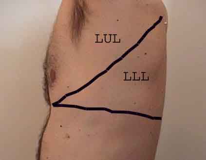 Left  thorax anatomy