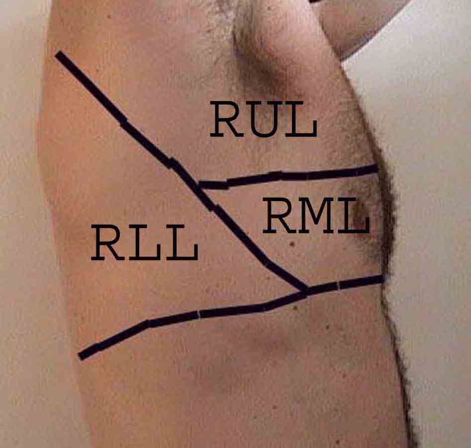 Right  thorax anatomy