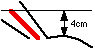 sternal angle